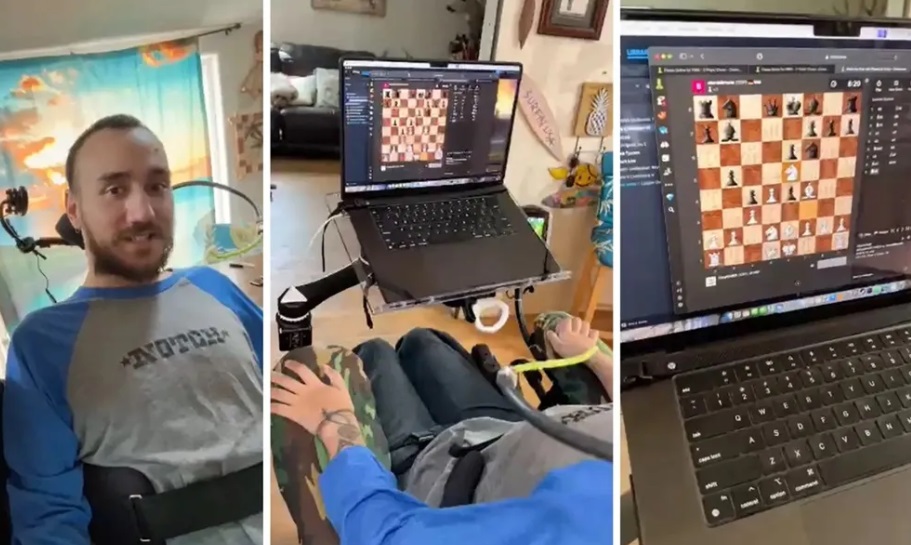 Първият човек с чип на Neuralink в мозъка играе шах онлайн само с мисълта си