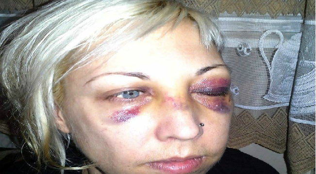 Полицай пребил жестоко млада жена, защото била без лични документи?!